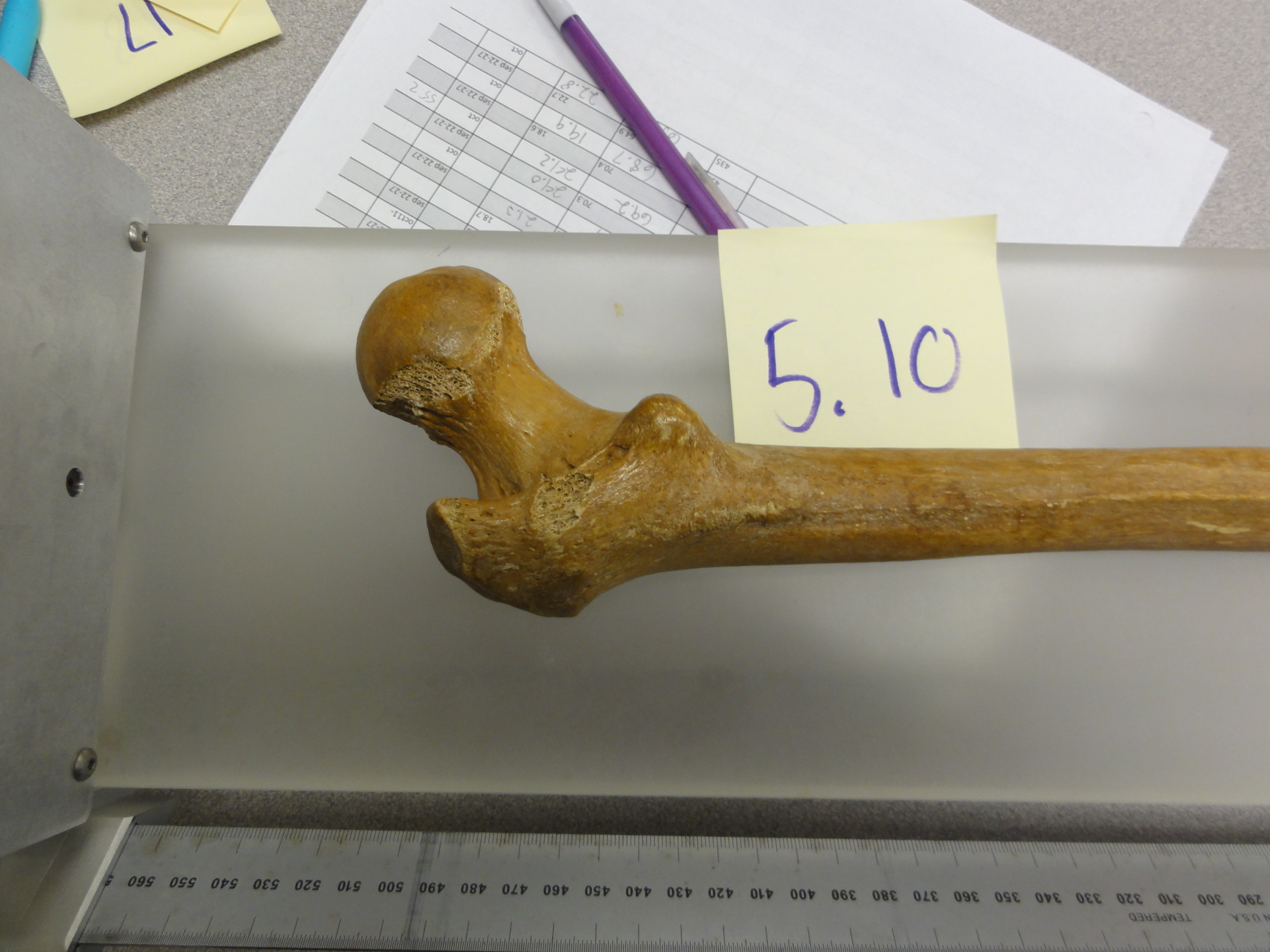 Showcase Image for Human Femoral Head Dimorphism Compared to Sex Differences in the Diaphysis of the Femur