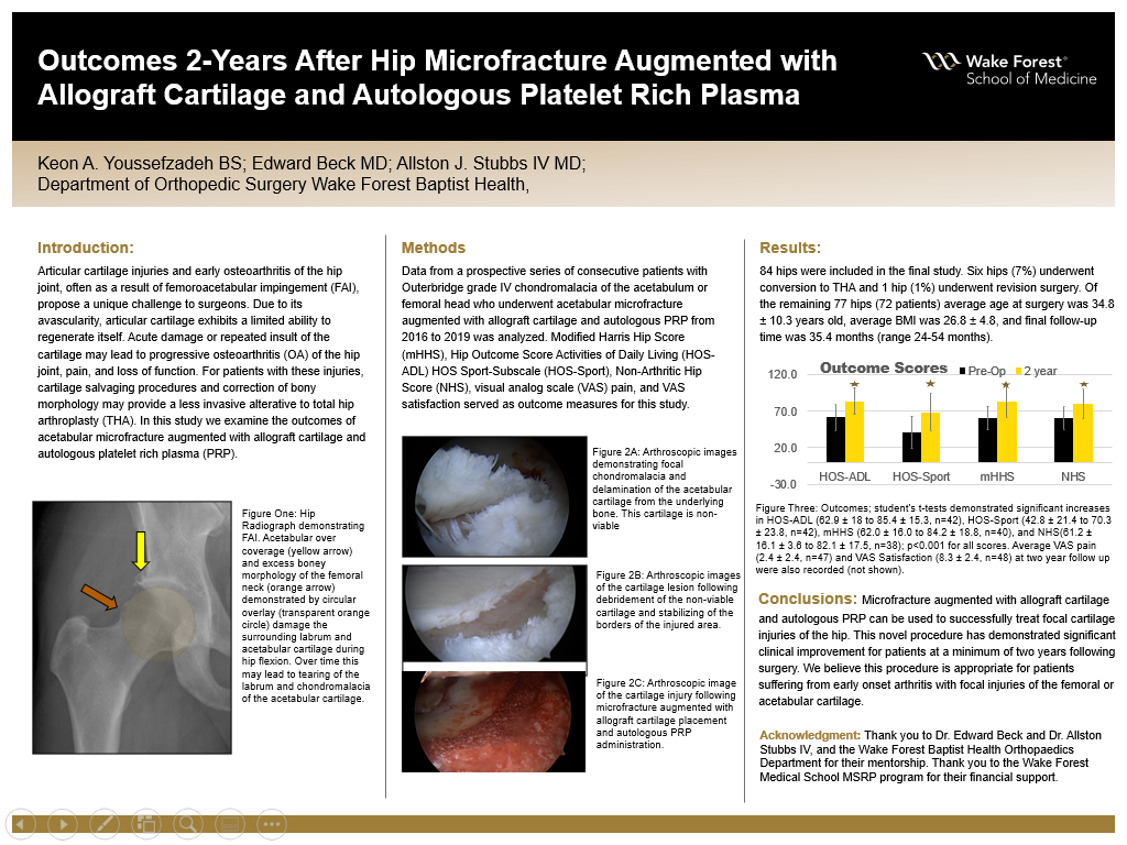 Showcase Image for Outcomes 2-Years After Hip Microfracture Augmented with Allograft Cartilage and Autologous Platelet Rich Plasma