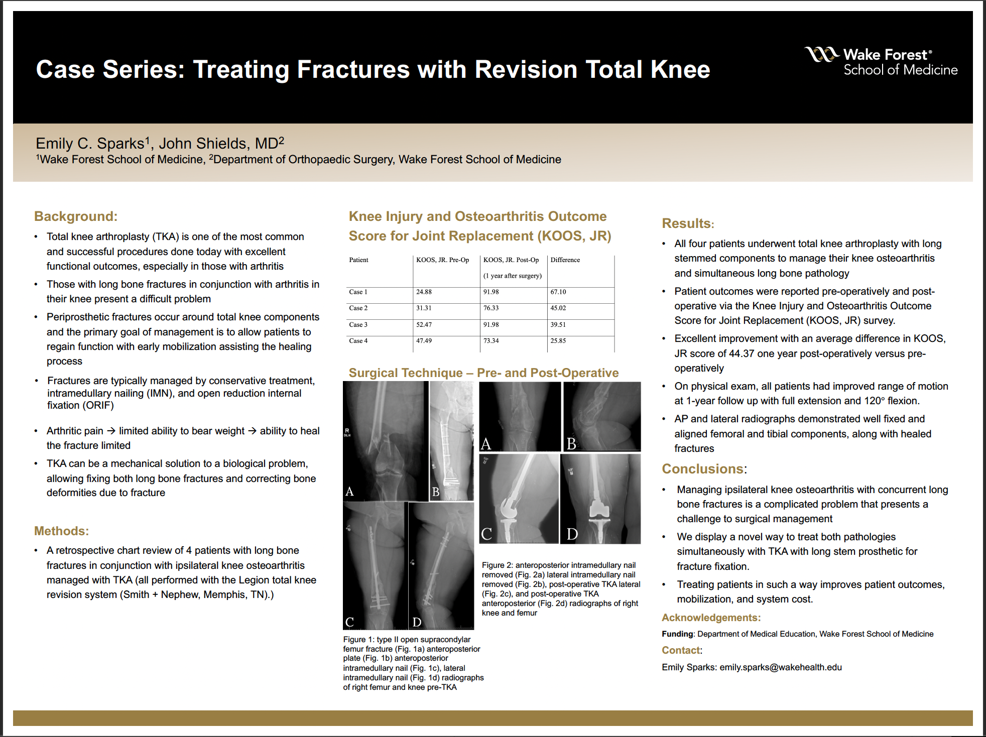 Showcase Image for Case Series: Treating Fractures with Revision Total Knee 