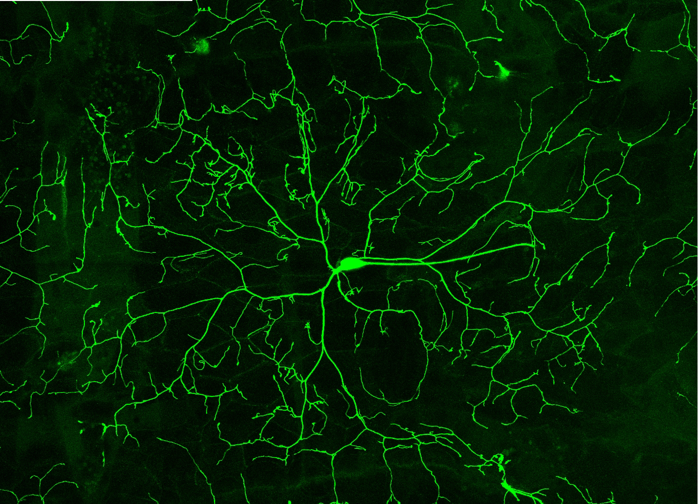 Showcase Image for The PP2A serine/threonine phosphatase complex functions in regulating dendritic morphology