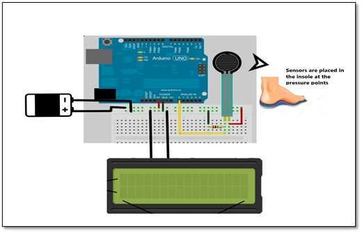 Showcase Image for EL 08 - Advanced Foot Pressure Detector System Using Arduino