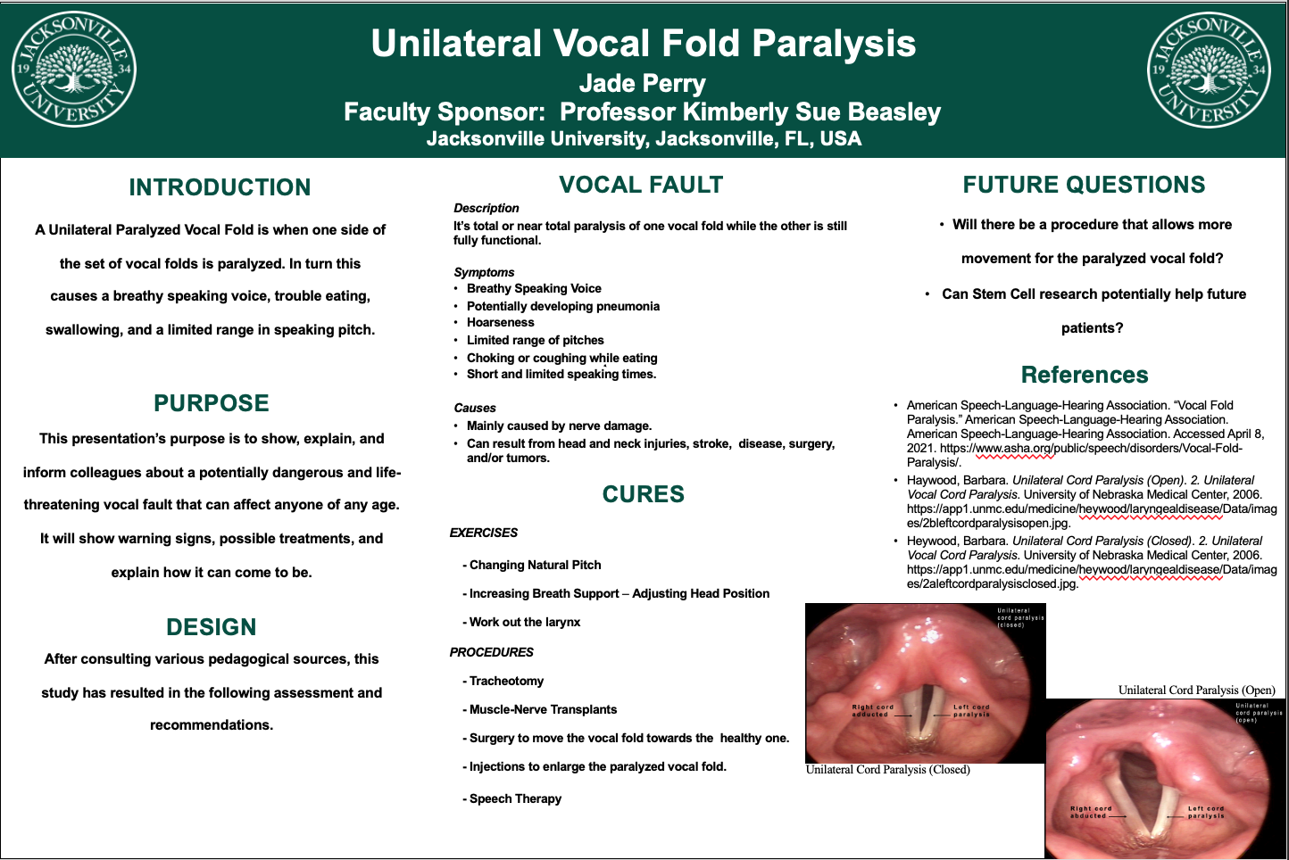 Showcase Image for Unilateral Vocal Fold Paralysis