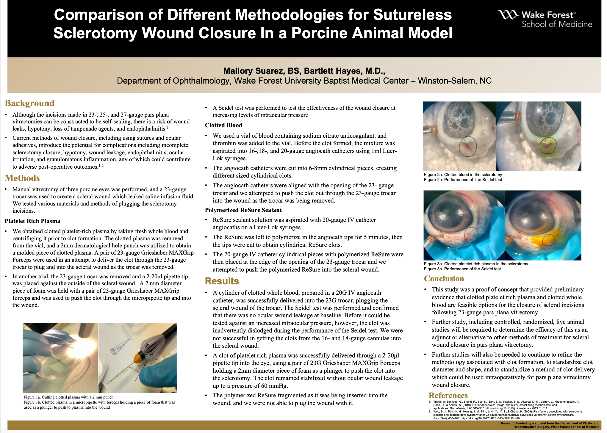 Showcase Image for Comparison of Different Methodologies for Sutureless Sclerotomy Wound Closure In a Porcine Animal Model 