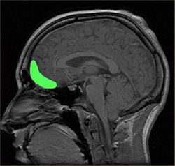 Showcase Image for Effect of Electric Fields on Brain Cells in Different Mediums