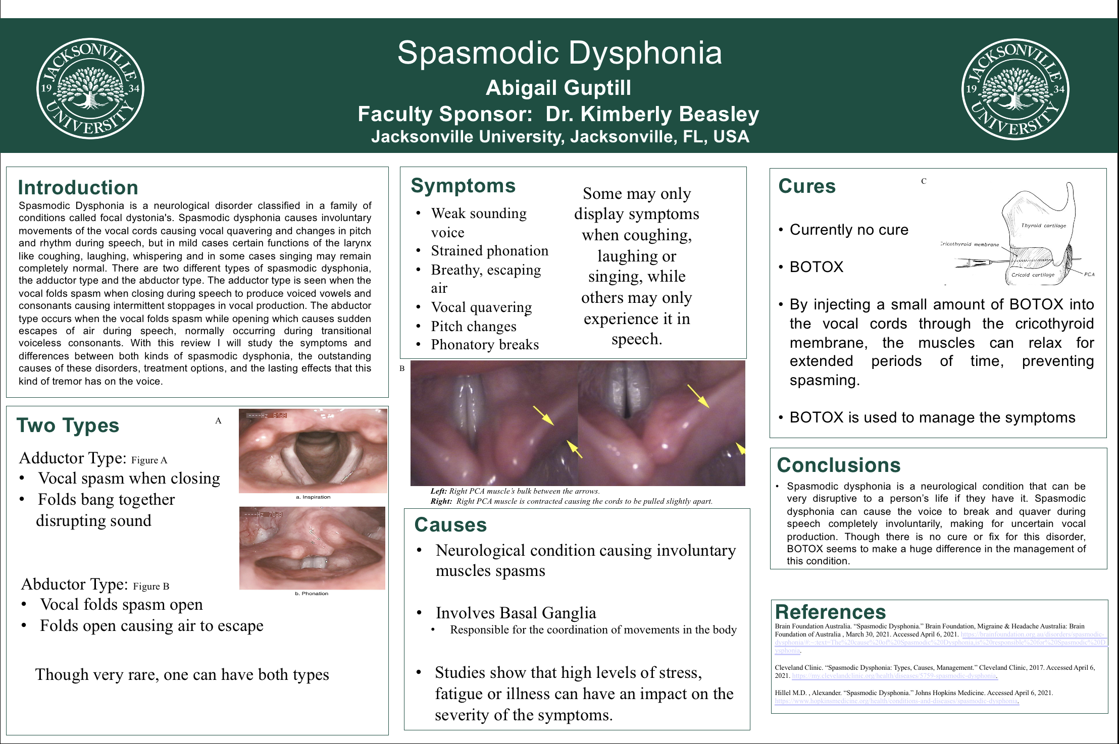 Showcase Image for Spasmodic Dysphonia 