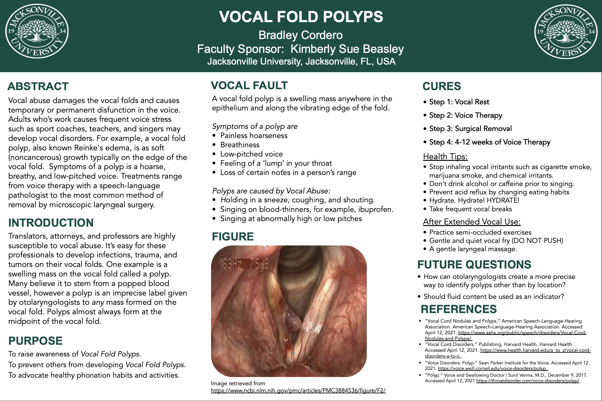 Showcase Image for Vocal Fold Polyps