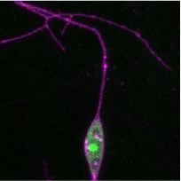 Showcase Image for Ribosomal Proteins Have Heterogeneous Effects on Dendritic Morphology in CI md Neurons