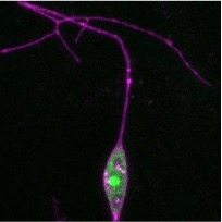 Showcase Image for Ribosomal Proteins Have Heterogeneous Effects on Dendritic Morphology in CI md Neurons