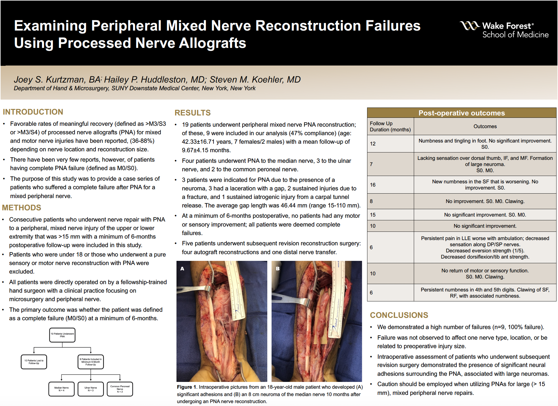 Showcase Image for Examining Peripheral Mixed Nerve Reconstruction Failures Using Processed Nerve Allografts 